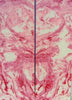 Blush Inlace Acrylester #103 (2 pc) Knife Scales  3/8"x2"x6"    001