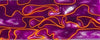 Purple Neon BTW94KSM Acrylic (2 pc) Knife Scaless 1/4" x 1 1/2" x 5"