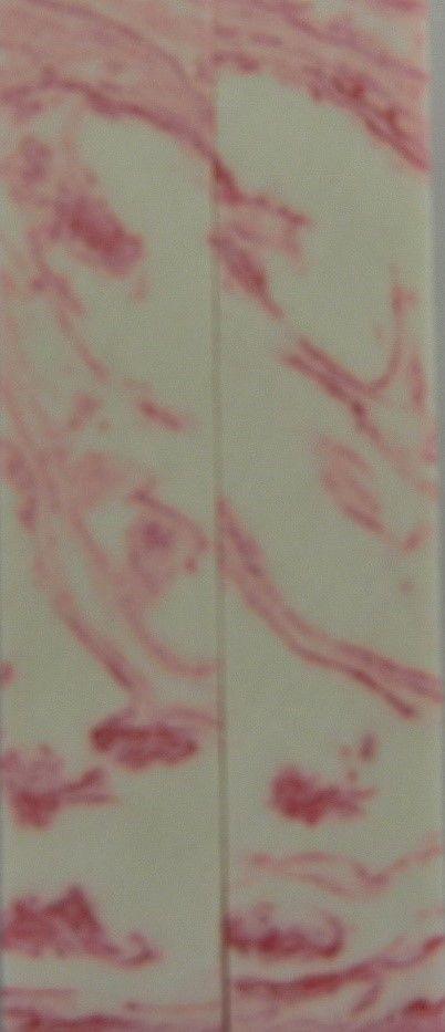Raspberry Parfait Acrylester #68 (2 pc) Mini Knife Scales  3/16" x 1" x 5    --1 - Wood Acrylic Supply