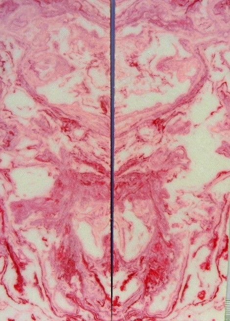 Blush Inlace Acrylester #103 (2 pc) Knife Scales  3/8"x2"x6"    001 - Wood Acrylic Supply