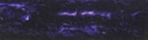 Deep Purple Acrylester #04 1" x 1" x 6" Pen Blank (1 pc)