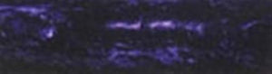 Deep Purple Acrylester #04 1" x 1" x 6" Pen Blank (1 pc)